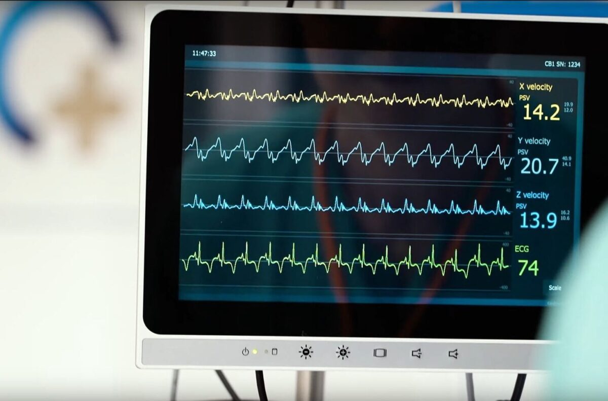 Medical innovation with Cardiaccs